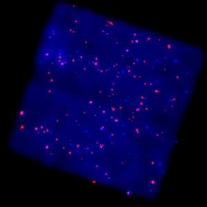 Chandra's image of the 'zone of avoidance.'