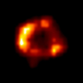 Chandra image of SN1987A