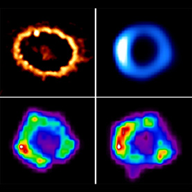 Hubble, Chandra and ...  images of SN1987A